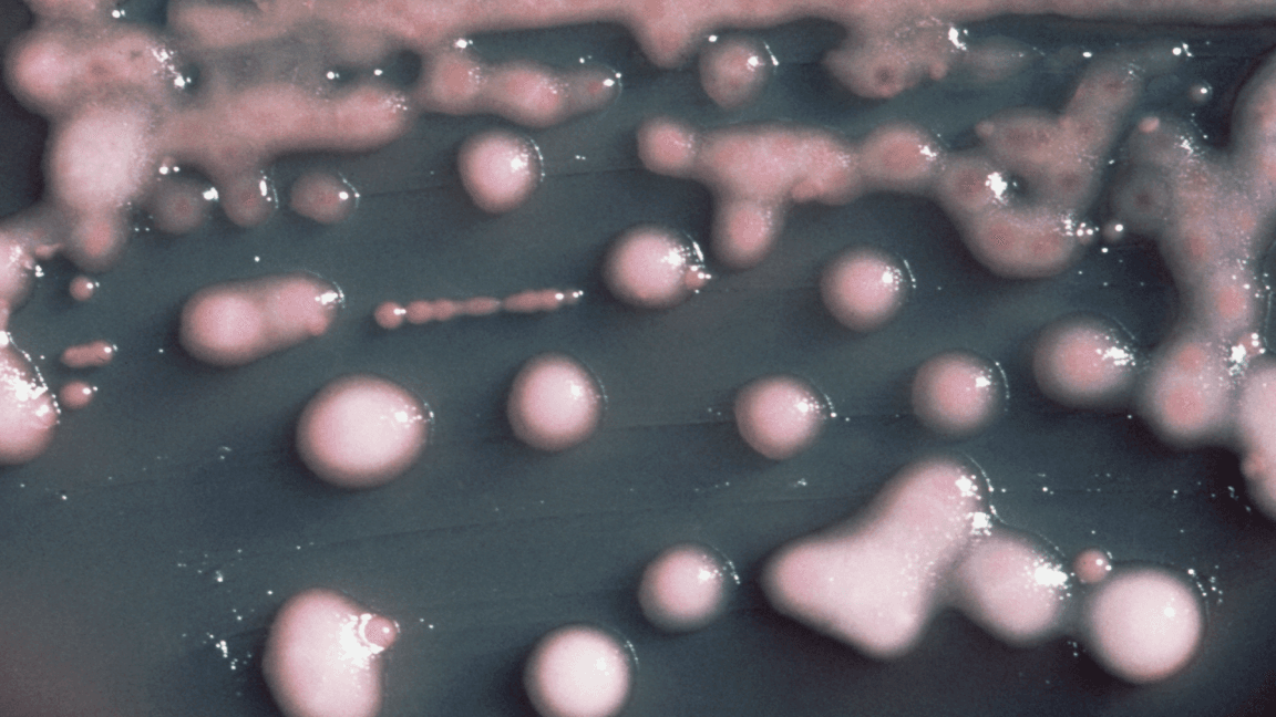 Bacteria's Two-Year Evolution Leads Brain Invasion Discovery