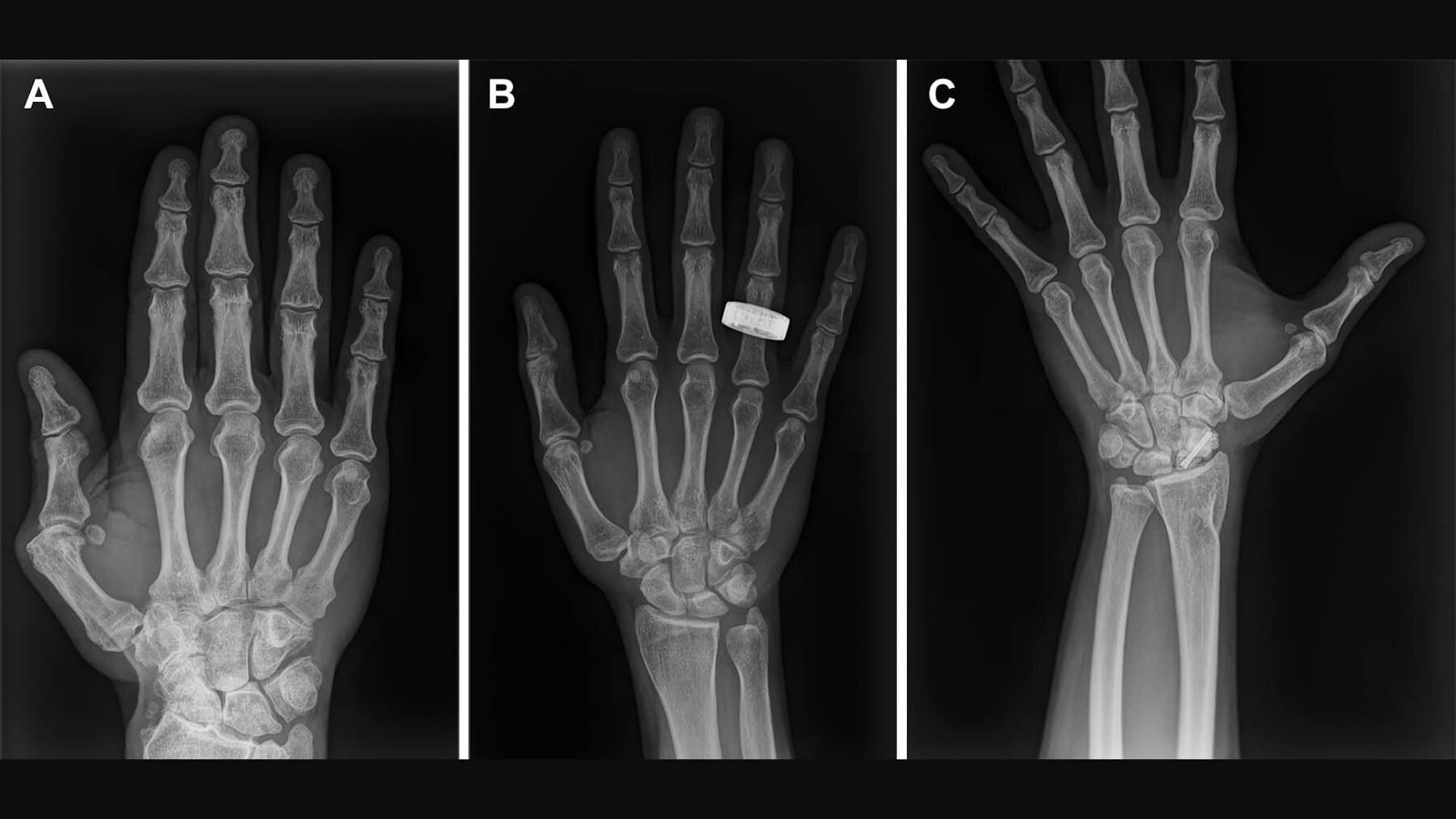 Space Station Gets First X-Ray Imaging Capability