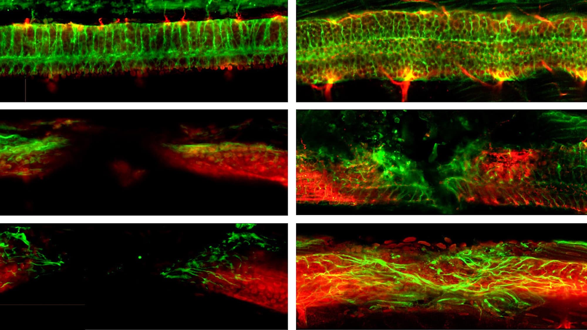 Nanorobots Loaded With Stem Cells Could Repair Spinal Damage